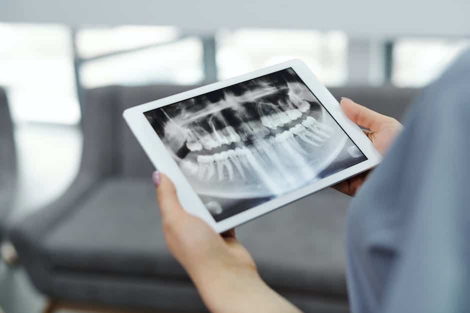 An image of a dental surgeon removing a wisdom tooth.